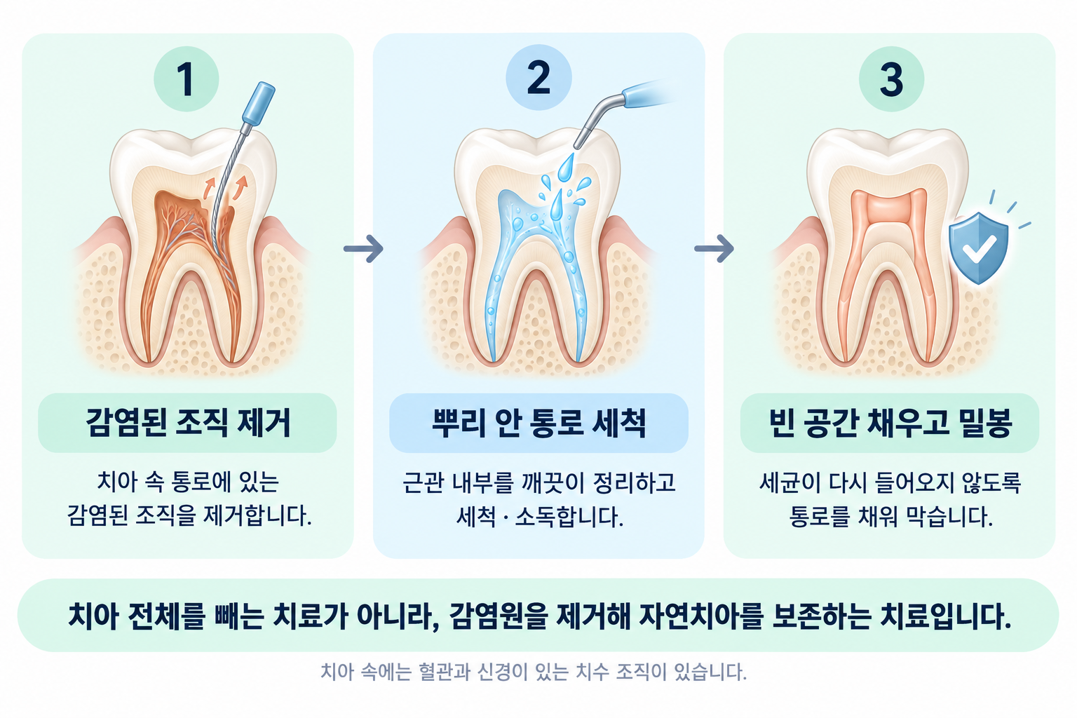 중랑구 신경치료는 무엇을 꺼내는 치료인가요 - 오늘치과의원