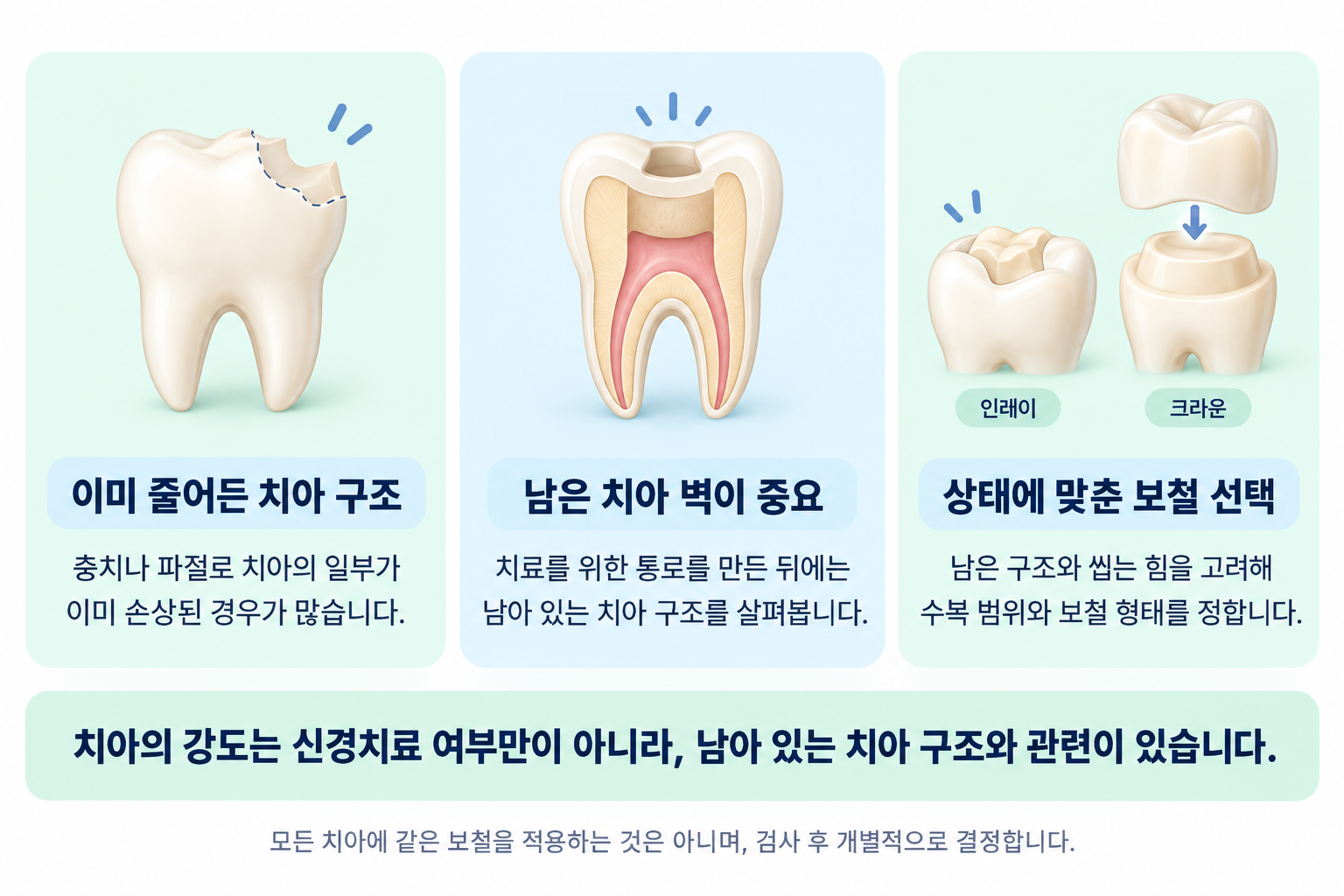 중랑구 신경치료 - 치료가 끝난 치아는 왜 약해지나요, 오늘치과의원